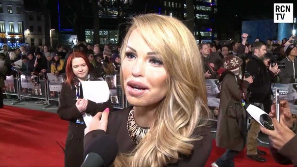 Katie Piper Interview New Documentary, Dating