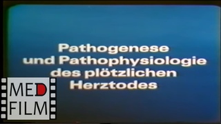 Herztodes: Pathogenese und Pathophysiologie  Патогенез и патофизиология сердечной смерти