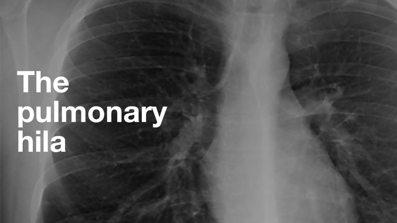 The Pulmonary