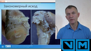 Дисплазия тазобедренного сустава как лечить