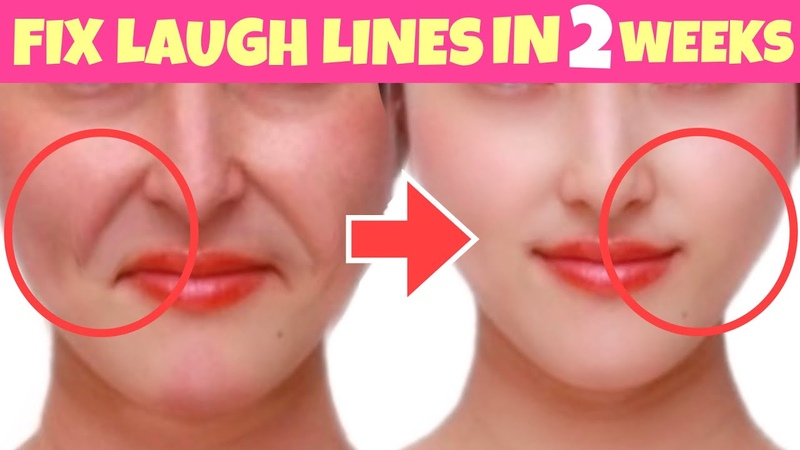 Anti Aging Facial Exercises For Laugh Lines, Sagging Jowls, Buccal Fat Look 10 Years